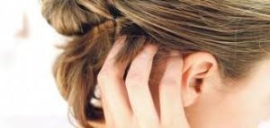سبب و علاج حكة فروة الراس وتساقط الشعر