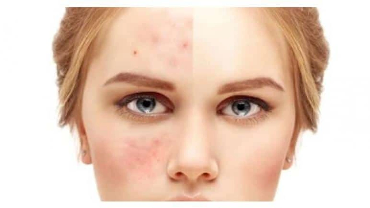 صورة صابون تبييض الوجه