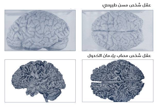 صور عن اضرار المخدرات 2020