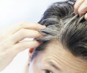علاج الشيب المبكر