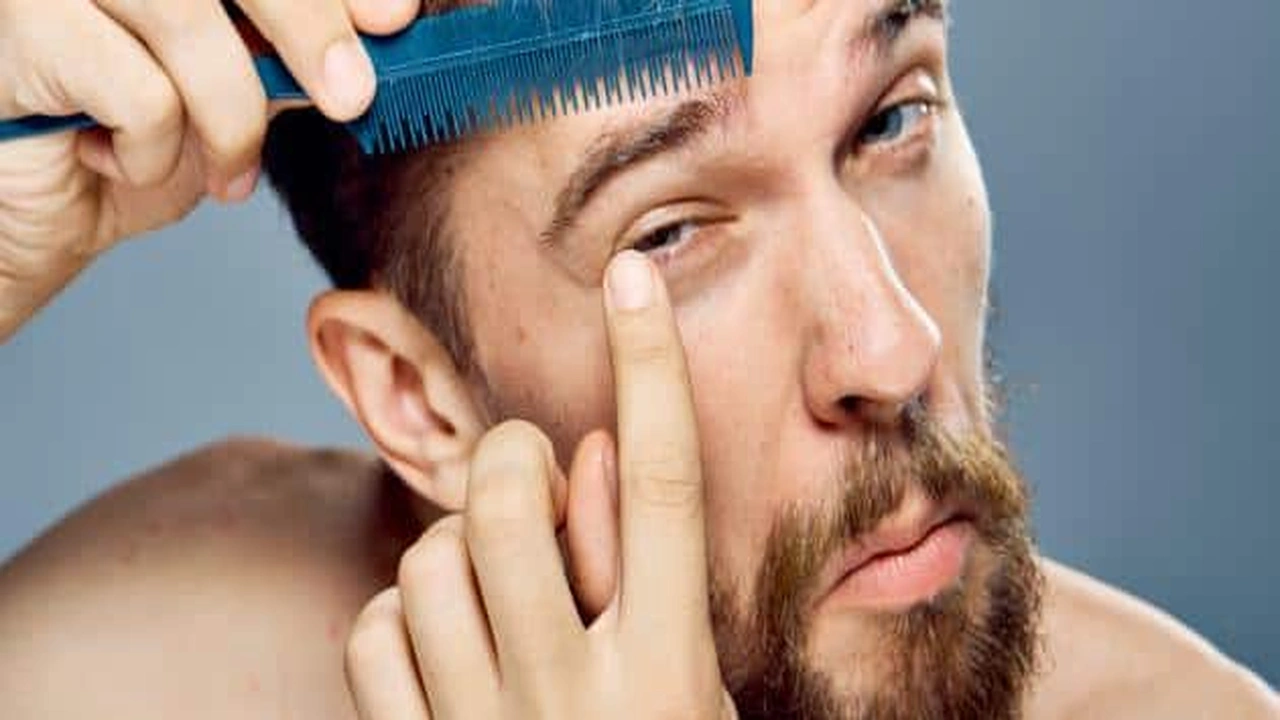 صورة علاج شيب الحواجب المبكر