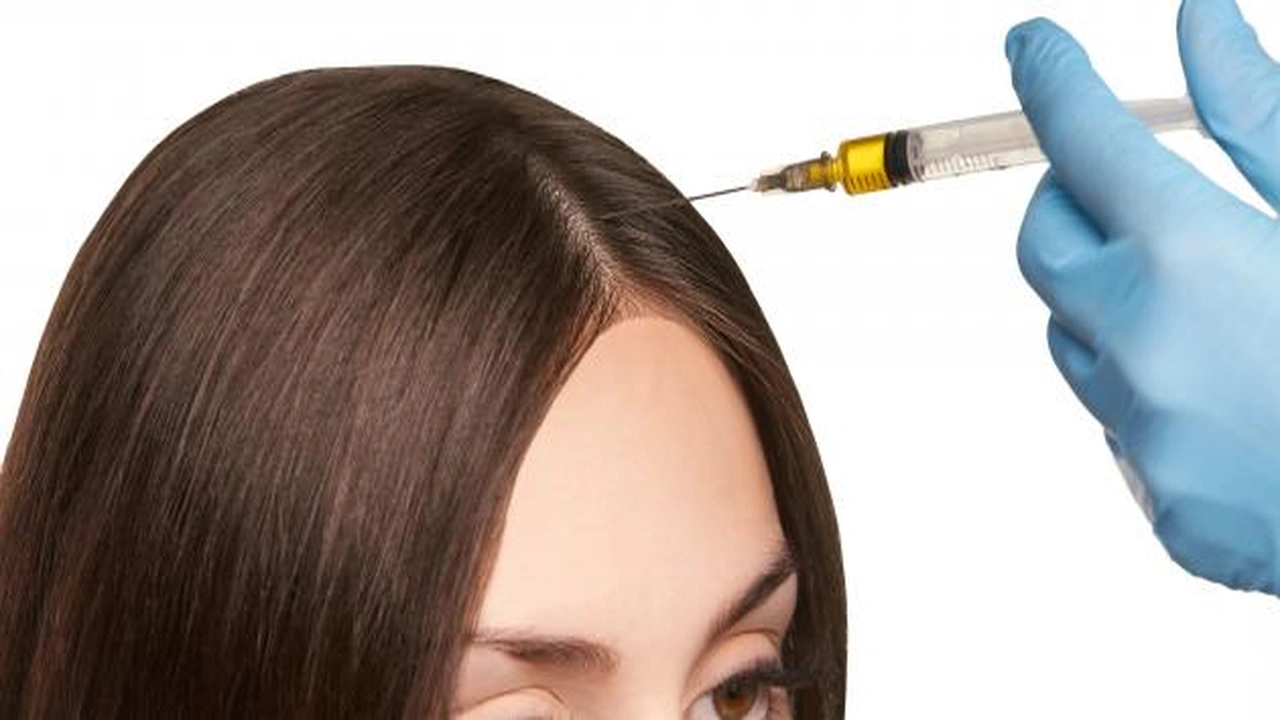 صورة فوائد حقن البلازما للشعر