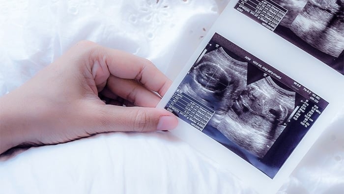 قصص واقعية عن اخطاء السونار