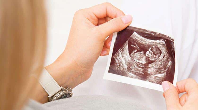 قصص واقعية عن اخطاء السونار