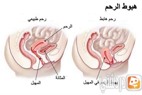 كيف اعرف أن الرحم رجع لوضعه الطبيعي بعد الولادة