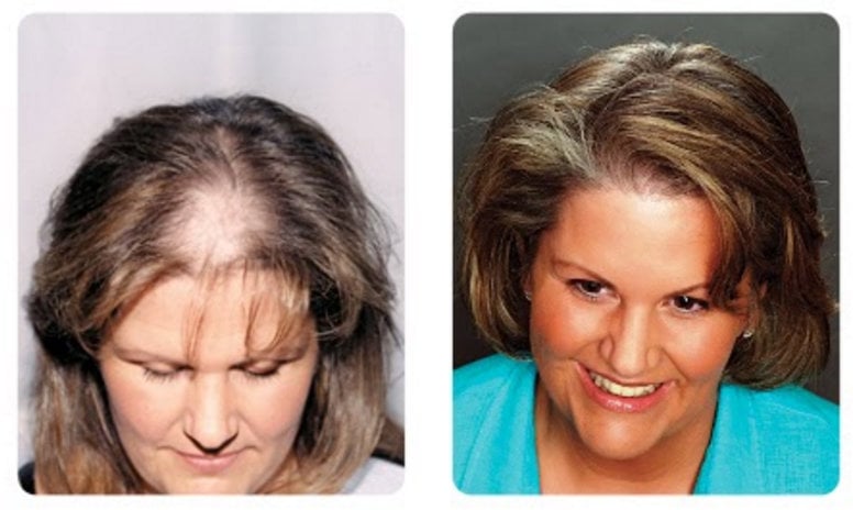 كيف اعرف انها ثعلبه