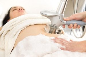 متى تظهر نتائج جلسات الكرايو