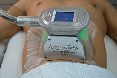 متى تظهر نتائج جلسات الكرايو