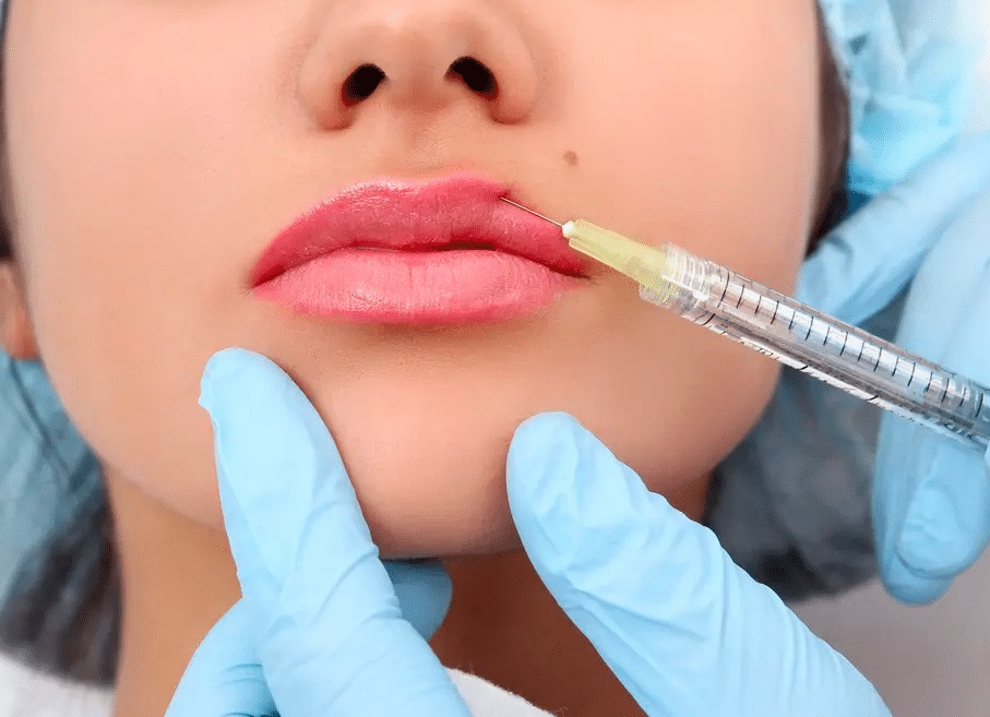 متى تظهر نتيجة حقن الفيلر