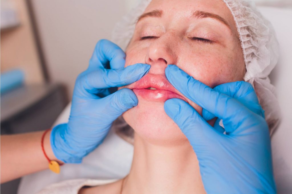 متى تظهر نتيجة حقن الفيلر