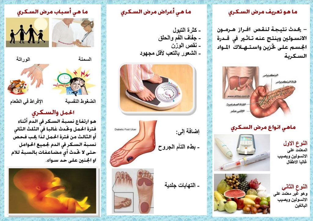 مطويات عن السمنة