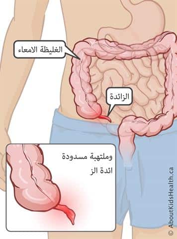 معلومات عن عملية الزايده