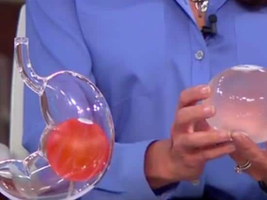 مميزات وعيوب عملية بالون المعدة