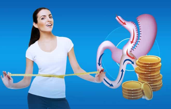 مميزات وعيوب عملية تكميم المعدة