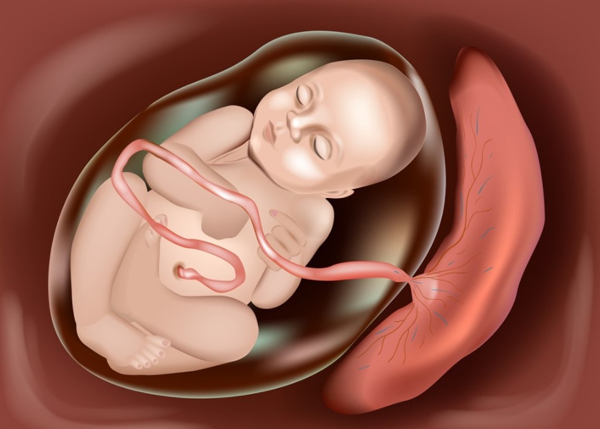 مين صار معها انفصال في المشيمة