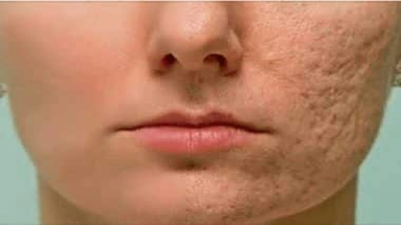 صورة نصائح لبشرة خالية من الحبوب