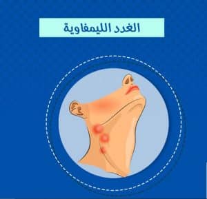 نصائح لمرضى سرطان الغدد اللمفاوية